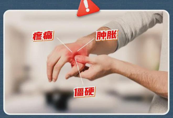 酸、手麻、腱鞘问题推荐用它！球盟会最新小米生态杀疯了！手(图8)